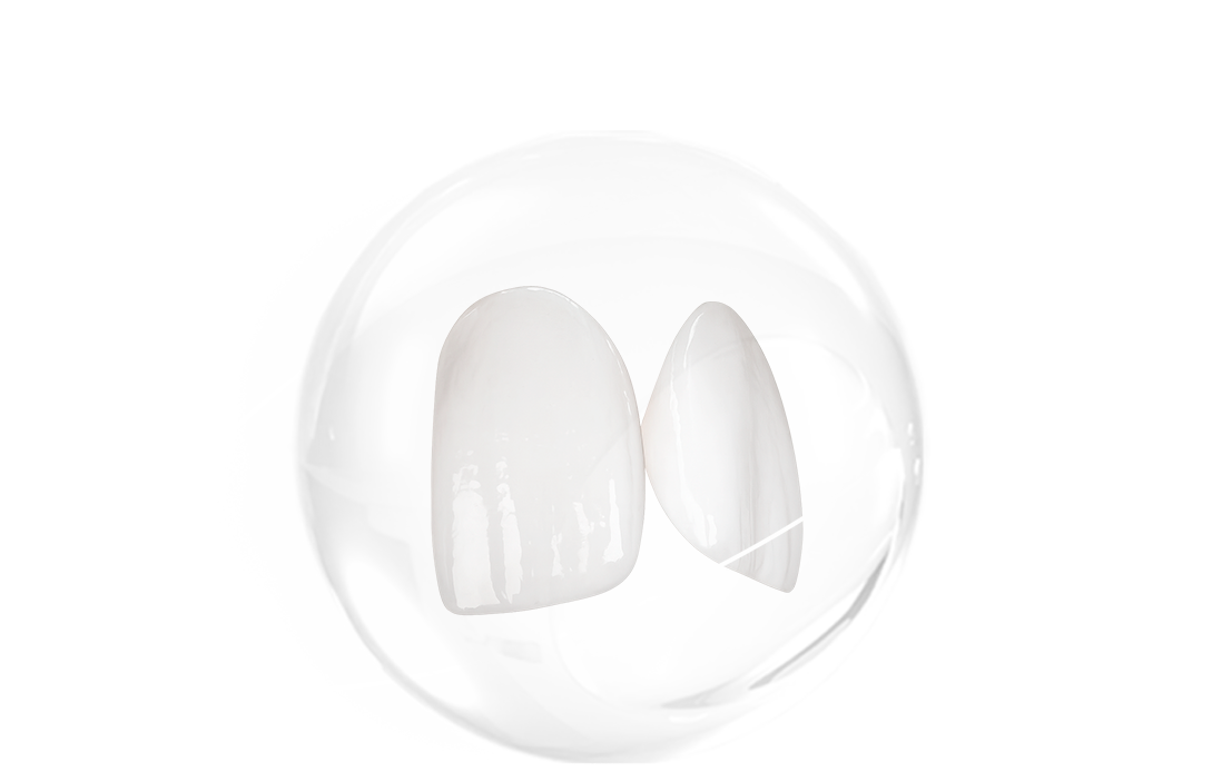 무삭제-라미네이트